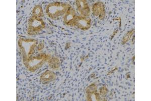 ABIN6276890 at 1/100 staining Human uterus tissue by IHC-P. (Vip antibody  (Internal Region))