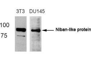 Western blot analysis of extracts from 3T3 and DU145 cells using Niban-like protein(Ab-712) antibody. (MEG3 antibody)