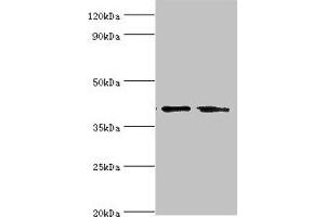 Western blot All lanes: LGALS9 antibody at 14 μg/mL Lane 1: Hela whole cell lysate Lane 2: Jurkat whole cell lysate Secondary Goat polyclonal to rabbit IgG at 1/10000 dilution Predicted band size: 40, 36, 35, 27, 26, 39 kDa Observed band size: 40 kDa (Galectin 9 antibody  (AA 1-240))