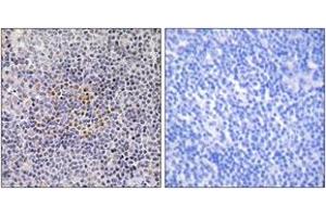 Immunohistochemistry analysis of paraffin-embedded human tonsil tissue, using XRCC3 Antibody. (RCC3 (AA 41-90) antibody)
