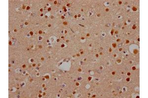 IHC image of ABIN7127644 diluted at 1:100 and staining in paraffin-embedded human brain tissue performed on a Leica BondTM system. (Recombinant Notch1 antibody)