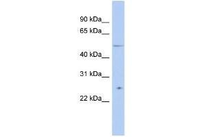 WB Suggested Anti-TTC8 Antibody Titration:  0. (TTC8 antibody  (N-Term))