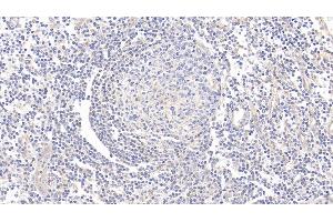 Detection of CD73 in Human Tonsil Tissue using Polyclonal Antibody to Cluster Of Differentiation 73 (CD73) (CD73 antibody  (AA 29-500))