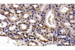 Detection of AST2 in Rat Kidney Tissue using Polyclonal Antibody to Aspartate Aminotransferase 2 (AST2) (AST2 (AA 30-430) antibody)