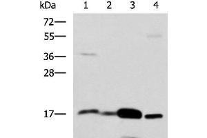 Western blot analysis of Mouse Pancreas tissue Mouse small intestines tissue Mouse large intestine tissue Human sigmoid tissue lysates using ZG16 Polyclonal Antibody at dilution of 1:1350 (ZG16 antibody)