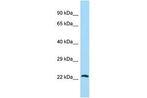 Host: Rabbit Target Name: ATG10 Sample Type: HepG2 Whole Cell lysates Antibody Dilution: 1. (ATG10 antibody  (C-Term))