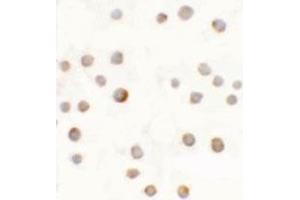 Immunocytochemical anyalysis of 293 cells with ABCA7 polyclonal antibody  at 5 ug/mL. (ABCA7 antibody  (N-Term))