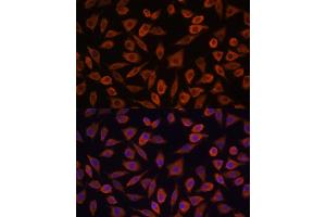 Immunofluorescence analysis of L929 cells using TSLP antibody (ABIN6128843, ABIN6149624, ABIN6149626 and ABIN6217014) at dilution of 1:100. (Thymic Stromal Lymphopoietin antibody  (AA 29-159))