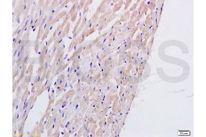 Formalin-fixed and paraffin embedded rat heart tissue labeled with Anti-PTAFR Polyclonal Antibody, Unconjugated (ABIN687127) at 1:200 followed by conjugation to the secondary antibody and DAB staining (PTAFR antibody  (AA 231-342))