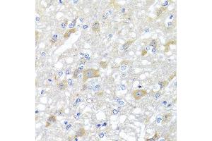 Immunohistochemistry of paraffin-embedded rat brain using INPP5K antibody at dilution of 1:100 (x40 lens). (INPP5K antibody)