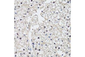 Immunohistochemistry of paraffin-embedded human liver using CDK7 antibody. (CDK7 antibody  (AA 211-346))