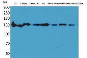 Western Blotting (WB) image for anti-Interleukin 16 (IL16) (C-Term) antibody (ABIN3178206) (IL16 antibody  (C-Term))
