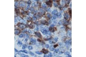 Immunohistochemical analysis of CD122 staining in human lymph node formalin fixed paraffin embedded tissue section. (IL2 Receptor beta antibody)