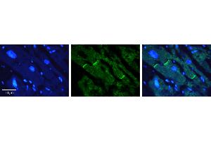 Rabbit Anti-CERS2 Antibody   Formalin Fixed Paraffin Embedded Tissue: Human heart Tissue Observed Staining: Plasma membrane in intercalated disk Primary Antibody Concentration: 1:100 Other Working Concentrations: N/A Secondary Antibody: Donkey anti-Rabbit-Cy3 Secondary Antibody Concentration: 1:200 Magnification: 20X Exposure Time: 0. (Ceramide Synthase 2 antibody  (N-Term))