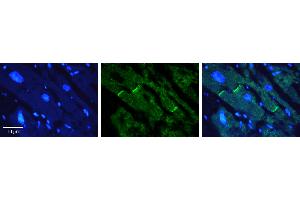 Rabbit Anti-CERS2 Antibody   Formalin Fixed Paraffin Embedded Tissue: Human heart Tissue Observed Staining: Plasma membrane in intercalated disk Primary Antibody Concentration: 1:100 Other Working Concentrations: N/A Secondary Antibody: Donkey anti-Rabbit-Cy3 Secondary Antibody Concentration: 1:200 Magnification: 20X Exposure Time: 0. (Ceramide Synthase 2 antibody  (N-Term))