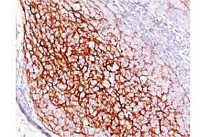 IHC testing of human tonsil stained with CD35 antibody (E11). (CD35 antibody)