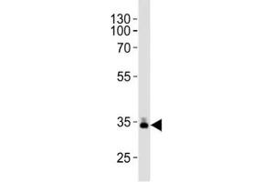 Western blot analysis of lysate from human plasma tissue lysate using ApoE antibody diluted at 1:1000. (APOE antibody  (AA 263-292))