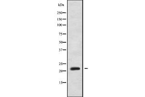 Western blot analysis NOLA1 using HUVEC whole cell lysates (GAR1 antibody  (Internal Region))