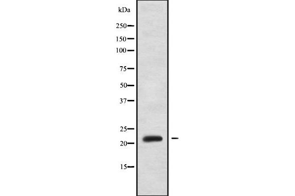 GAR1 antibody  (Internal Region)