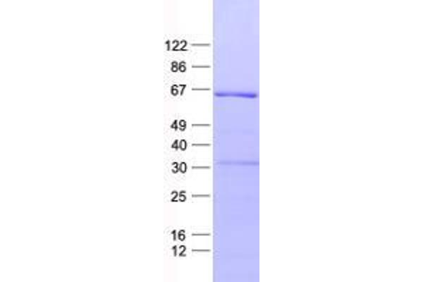 ZNF426 Protein (His tag)