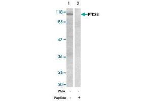 Western blot analysis of the extracts from Jurkat cells untreated or treated with PMA using PTK2B polyclonal antibody  . (PTK2B antibody)