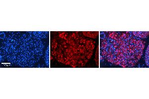 Rabbit Anti-SAAntibody   Formalin Fixed Paraffin Embedded Tissue: Human Testis Tissue Observed Staining: Cytoplasm in spermatogonia and spermatocytes Primary Antibody Concentration: N/A Other Working Concentrations: 1:600 Secondary Antibody: Donkey anti-Rabbit-Cy3 Secondary Antibody Concentration: 1:200 Magnification: 20X Exposure Time: 0. (SAP18 antibody  (N-Term))