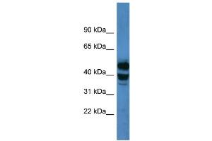 WB Suggested Anti-CYP21A2 Antibody Titration: 0. (CYP21A2 antibody  (C-Term))