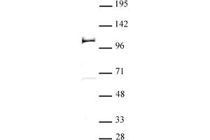 PHF20 antibody (pAb) tested by Western blot 20 μg nuclear extract of F9 retinoic acid -treated mouse teratocarcinoma stem cells probed with PHF20 antibody (1:500).