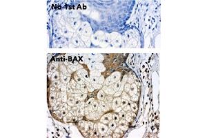 Immunohistochemistry (IHC) image for anti-BCL2-Associated X Protein (BAX) (N-Term) antibody (ABIN6254209) (BAX antibody  (N-Term))