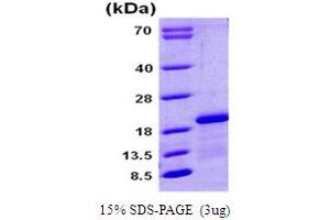 SDS-PAGE (SDS) image for Complexin 1 (CPLX1) (AA 1-134) protein (His tag) (ABIN666720)