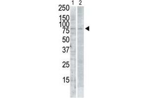 The anti-SNK C-term Pab is used in Western blot to detect SNK in PMA-treated Pam212 cell lysate (lane 1) and rat testis tissue lysate (lane 2). (PLK2 antibody  (C-Term))