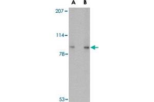 Western blot analysis of VPS53 in 293 cell lysate with VPS53 polyclonal antibody  at (A) 0. (VPS53 antibody  (C-Term))