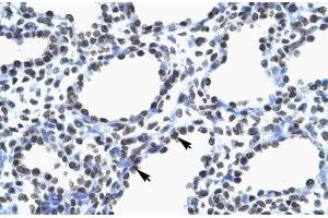 Human Lung; MYEF2 antibody - middle region in Human Lung cells using Immunohistochemistry (MYEF2 antibody  (Middle Region))