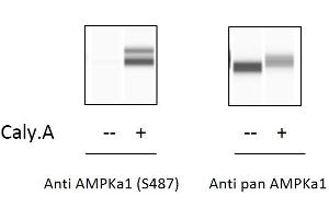 HeLa cells were treated or untreated with Calyculin A. (PRKAA1 ELISA Kit)