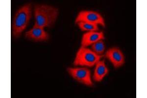 Immunofluorescent analysis of MOK staining in MDAMB231 cells. (MOK antibody  (Center))