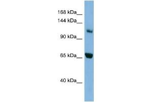 WB Suggested Anti-MYO1E Antibody Titration: 0. (MYO1E antibody  (Middle Region))