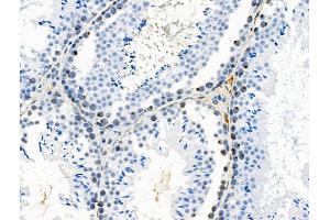 Phospho-MUNC-18a (Ser516) Antibody at 1/100 staining Mouse testis tissue by IHC-P.