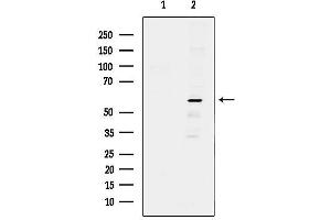 anti-Peter Pan Homolog (PPAN) (C-Term) antibody