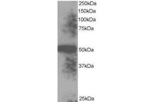 Image no. 1 for anti-Thioredoxin Domain Containing 5 (Endoplasmic Reticulum) (TXNDC5) (C-Term), (Isoform 1), (Isoform 3) antibody (ABIN374463) (TXNDC5 antibody  (C-Term, Isoform 1, Isoform 3))