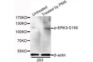 Western blot analysis of extracts of 293 cells, using Phospho-ERK3-S189 antibody. (MAPK6 antibody  (pSer189))