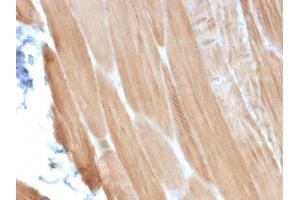 Formalin-fixed, paraffin-embedded human Skeletal Muscle stained with Sarcomeric Actinin Alpha 2 Mouse Monoclonal Antibody (ACTN2/3293)