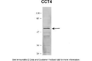 Sample Type: HEK 293 (10ug)Primary Dilution: 1:1000Secondary Antibody: conjugated goat anti-rabbitSecondary Dilution: 1:10,000Image Submitted By: Amy GrayBrigham Young University (CCT4 antibody  (C-Term))