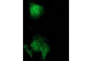 Anti-CAT mouse monoclonal antibody (ABIN2454281) immunofluorescent staining of COS7 cells transiently transfected by pCMV6-ENTRY CAT (RC210763). (Catalase antibody)