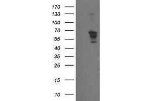 Western Blotting (WB) image for anti-Beclin 1, Autophagy Related (BECN1) antibody (ABIN1496865) (Beclin 1 antibody)