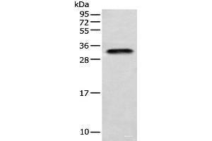 Western blot analysis of Human testis tissue using LYPD4 Polyclonal Antibody at dilution of 1:400 (LYPD4 antibody)