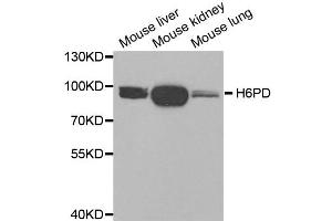 Western blot analysis of extracts of various tissues, using H6PD antibody. (Glucose-6-Phosphate Dehydrogenase antibody)
