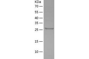 Western Blotting (WB) image for Surfeit 2 (SURF2) (AA 1-256) protein (His tag) (ABIN7287288) (SURF2 Protein (AA 1-256) (His tag))