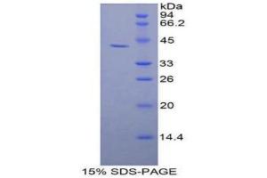 SDS-PAGE (SDS) image for Gelsolin (GSN) (AA 28-782) protein (His tag) (ABIN2122898)