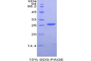 SDS-PAGE analysis of Mouse alpha Fodrin Protein.