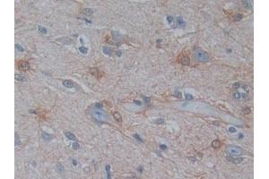 PSAT1 antibody  (AA 1-312)